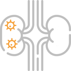 Rak nerki